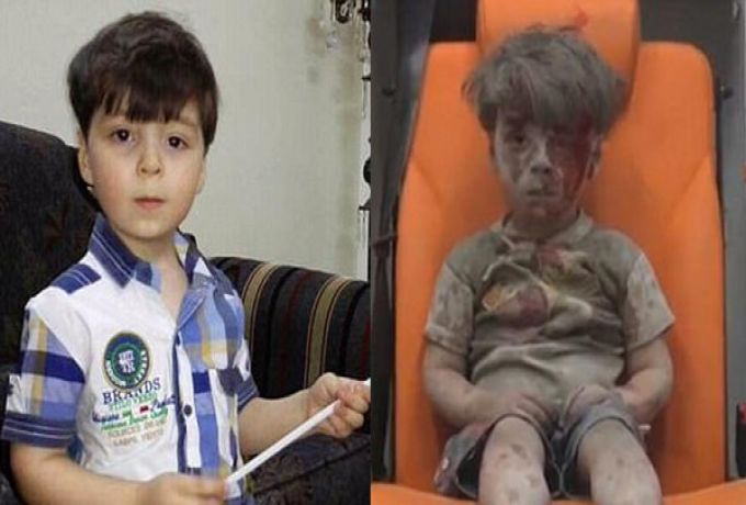 السوري عمران .. صورة جديدة لطفل الدموع والأنقاض